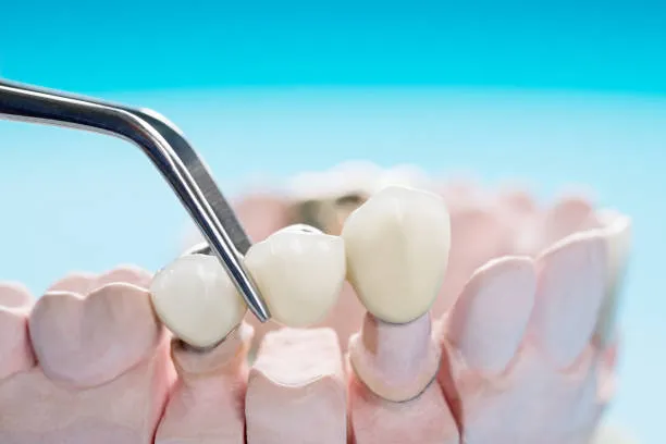 dentist in koramangala