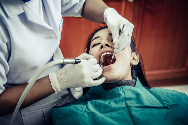 Wisdom Tooth Extraction