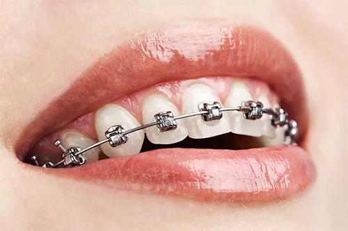 indiranagar dental clinic