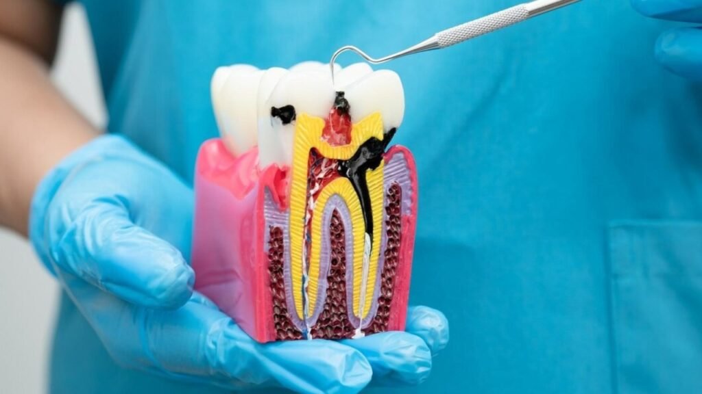 Root Canal Treatment in Koramangala