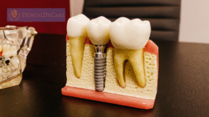 dental implant clinic 